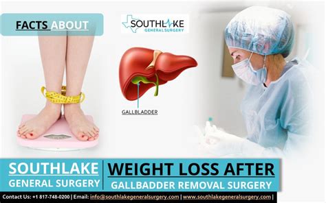 and do you lose weight after gallbladder removed